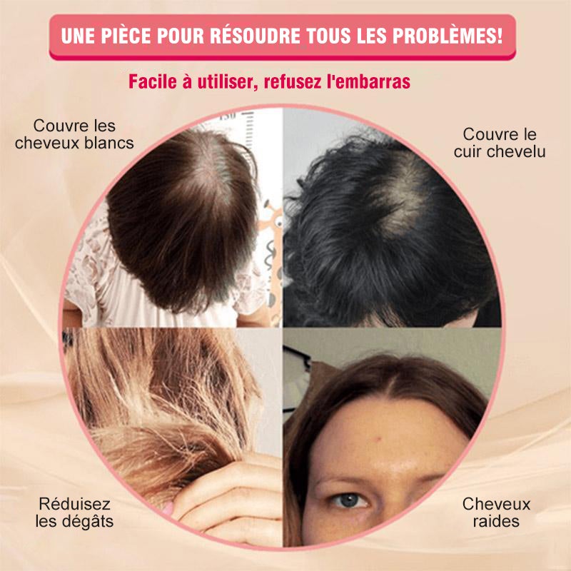 Patch de Remplacement de Perruque